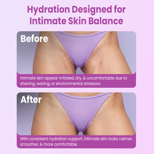 Bikini Mask Treatment Kit