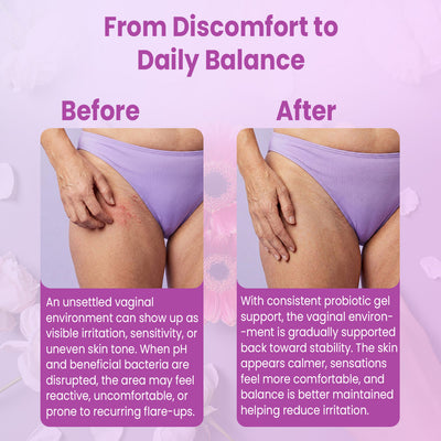 Vaginal Probiotic Gel