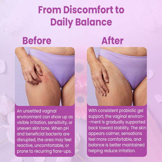 Vaginal Probiotic Gel