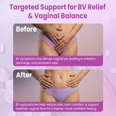 Bacterial Vaginosis Suppositories