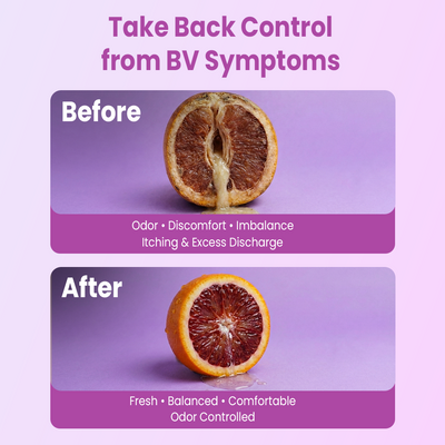 Bacterial Vaginosis Vaginal Gel