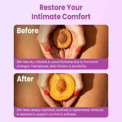 Vulva Balm