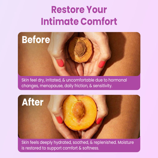 Vulva Balm