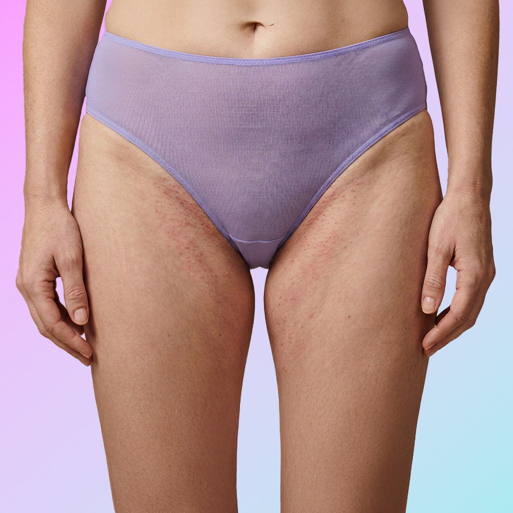 Before: Red • Bumpy • Irritated